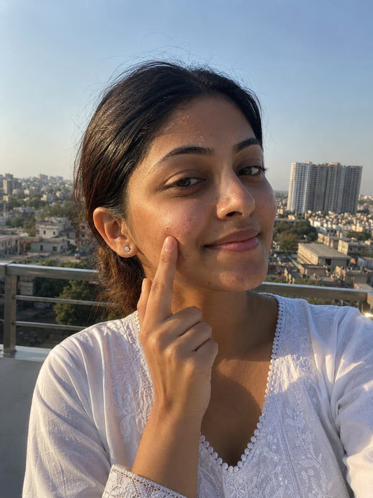 Summer Skincare Routine for Pakistani Skin (4 Steps) | Skin Lime