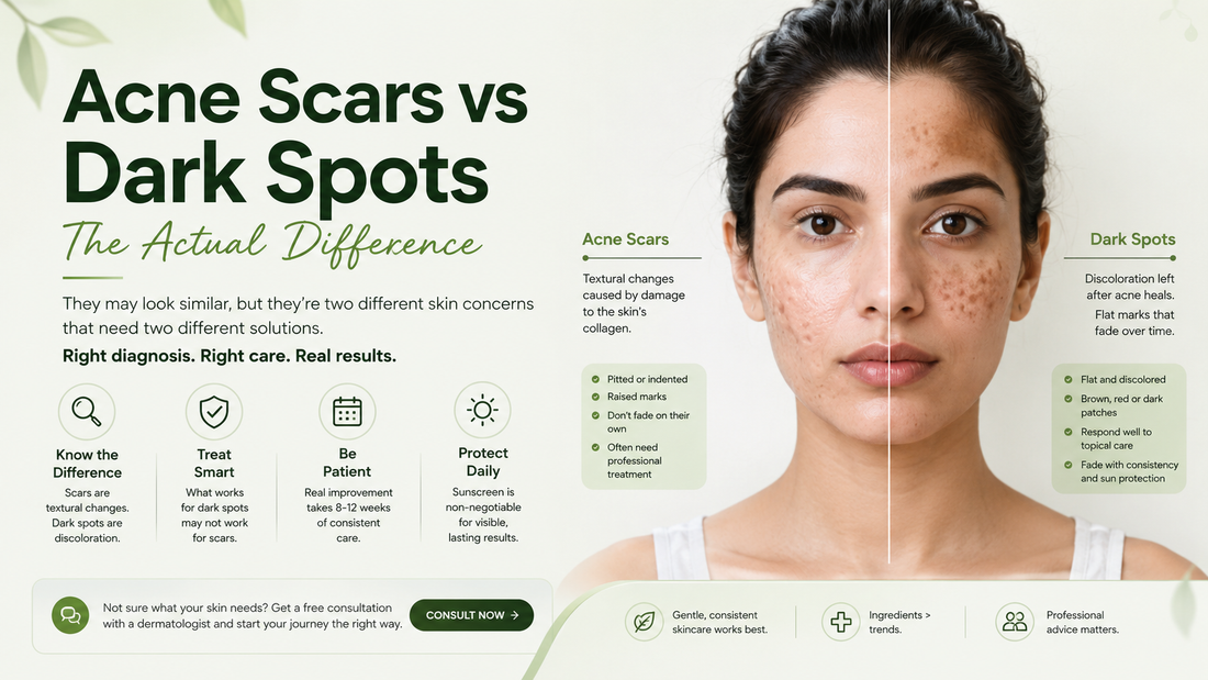 Acne scars vs dark spots comparison showing the actual difference between textured acne scarring and flat post-acne pigmentation.