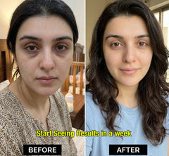 Skin Lime Melon Lift Under Eye Cream - For mothers running on 3 hours of sleep