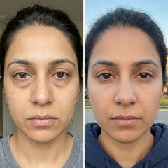 Skin Lime Melon Lift Under Eye Cream - Reduce Dark Circles & Puffiness